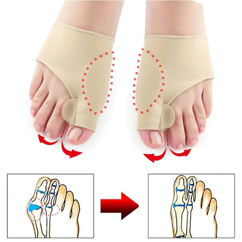 Corretor de Joanete Hallux Valgus, Endireitador de Dedos.